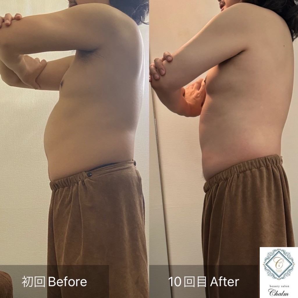 メンズ痩身 ビフォーアフター